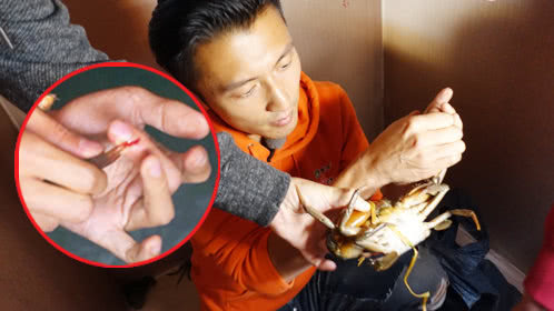 第8期：谢霆锋手指被蟹钳刺穿流血受伤