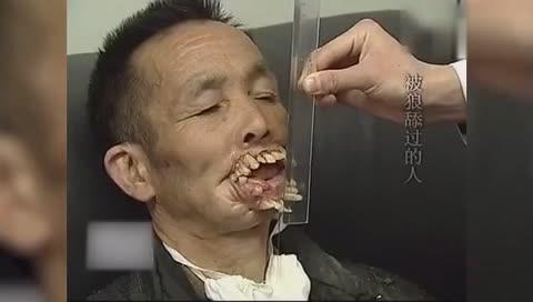被狼"舔"过后的男子,满嘴獠牙变怪物
