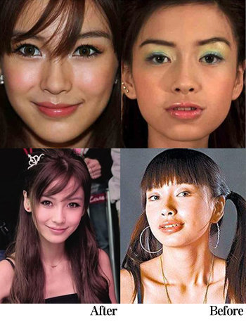 其实早在ab出道之时,关于她整容的议论就没有停过.