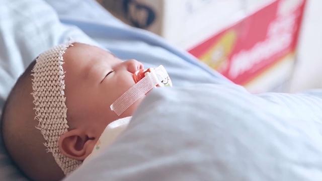 《生命缘》20150715连体婴儿“分离”记