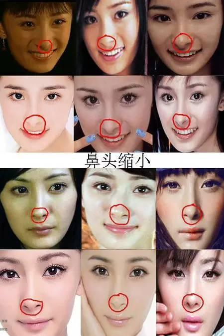有网友说:"杨幂缩小了鹰钩鼻,削了腮帮子,整了牙齿.